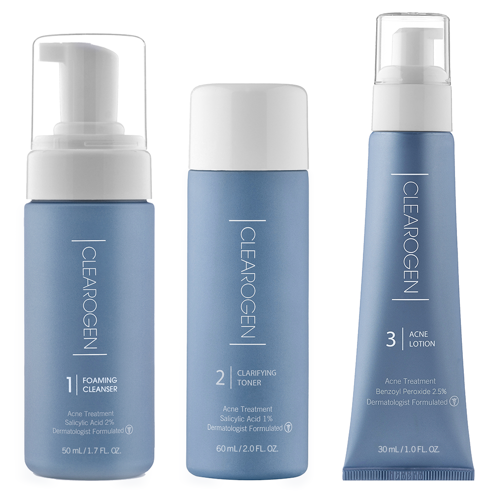 30-Day  Ultimate Acne Clearing 3-Step Treatment with 2.5% Benzoyl Peroxide - Clearogen