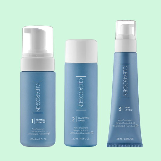 60-Day Ultimate Acne Clearing 3-Step Treatment with 2.5% Benzoyl Peroxide