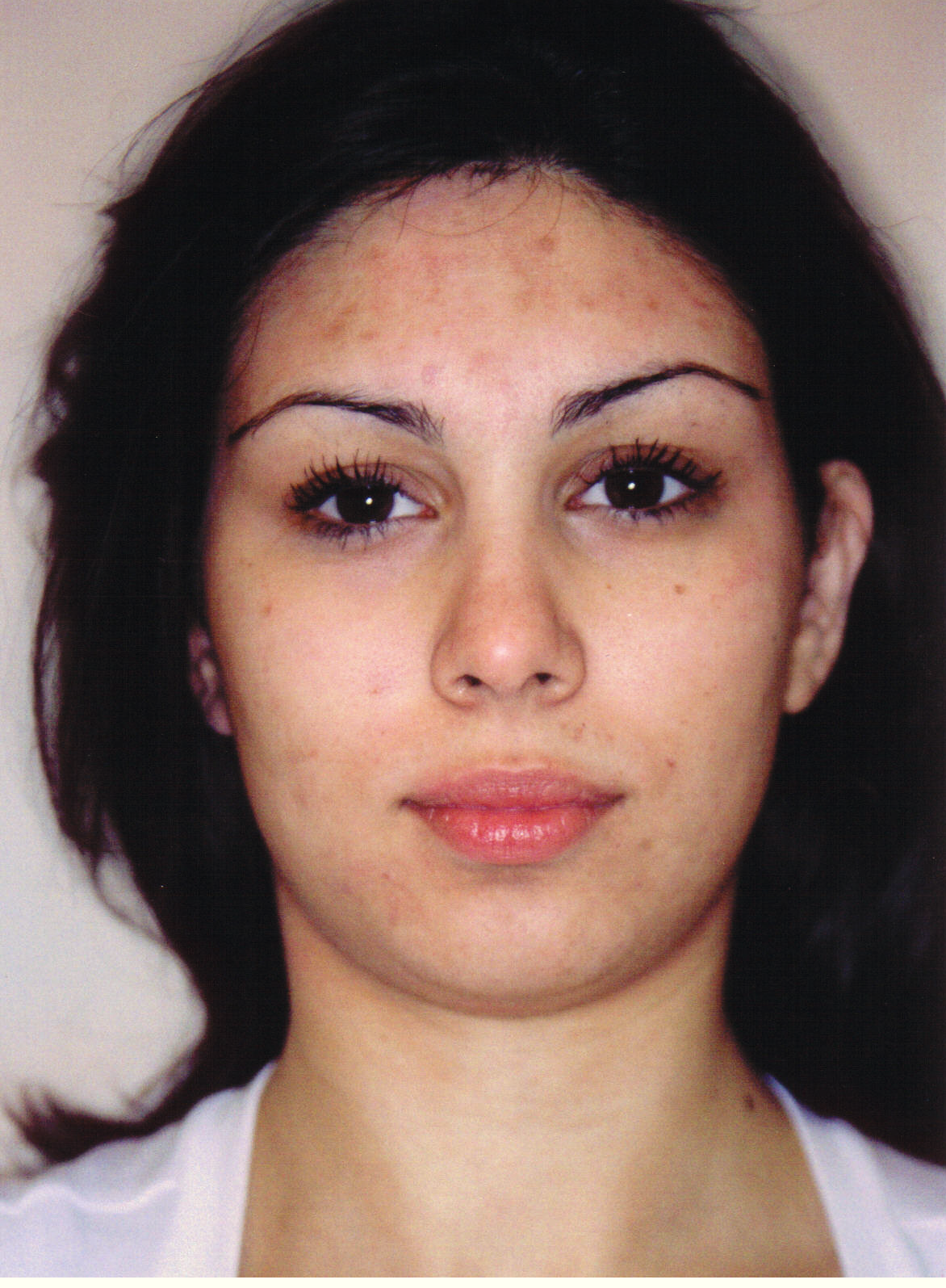 Before using Clearogen