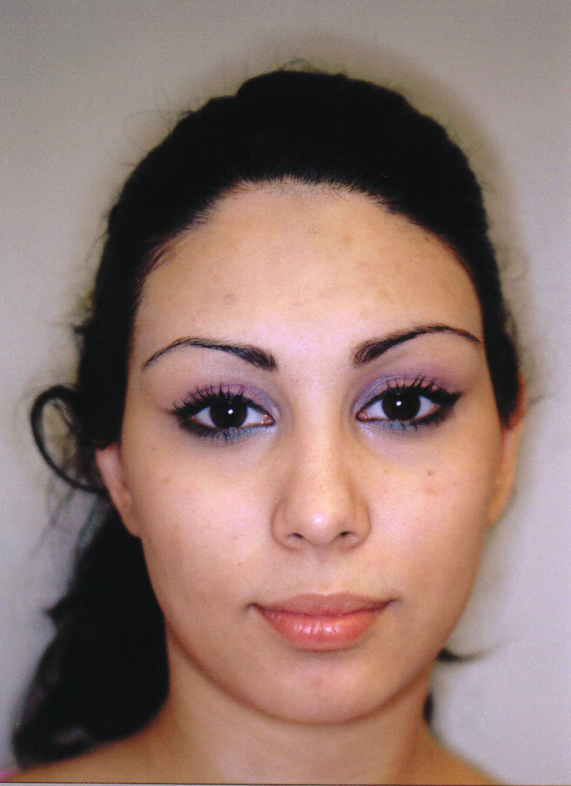 After using Clearogen