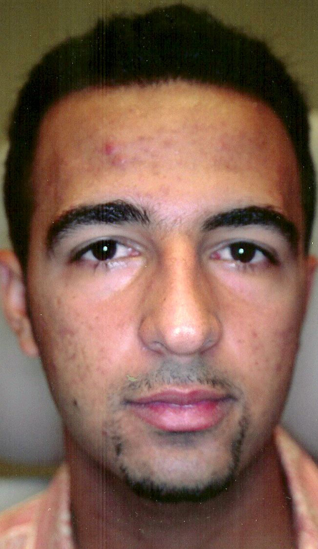 Before using Clearogen