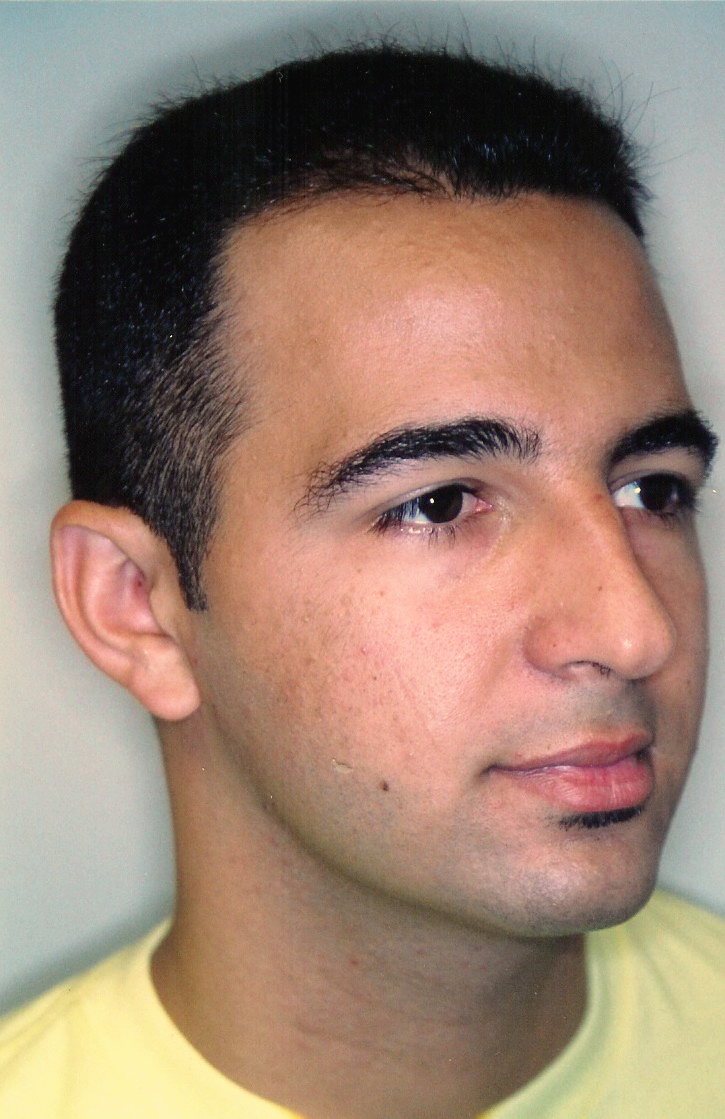 After using Clearogen