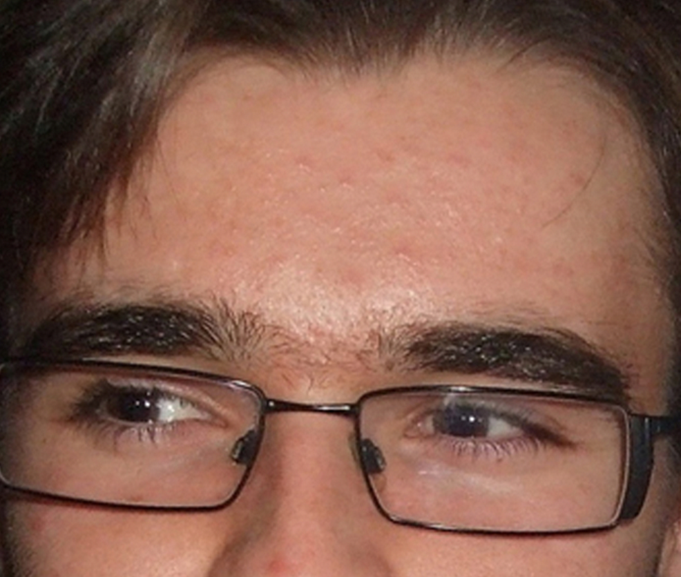 60-Day Clarifying & Renewing Skin Toner with 1% Salicylic Acid