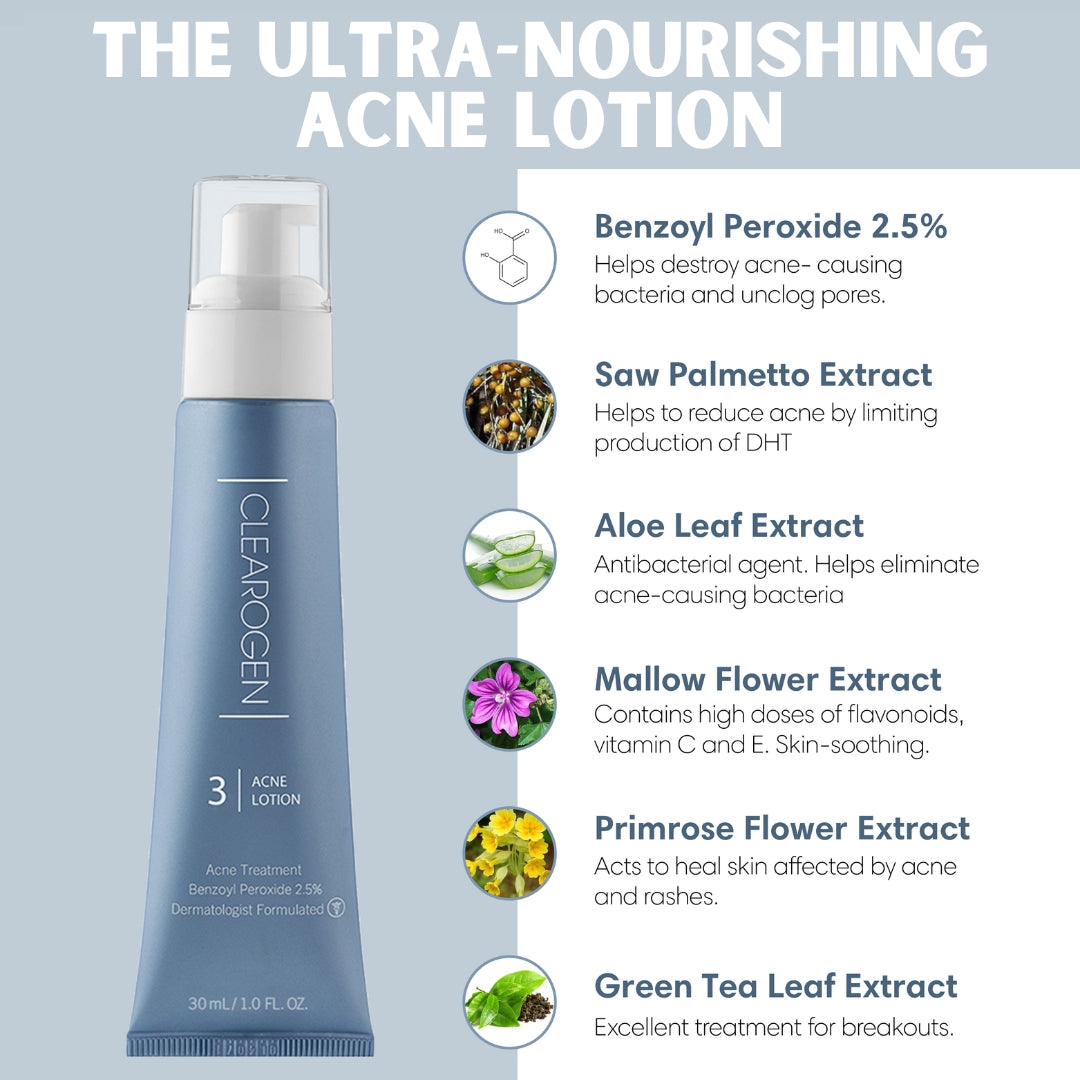 30 Day Benzoyl Peroxide Acne Lotion - Clearogen
