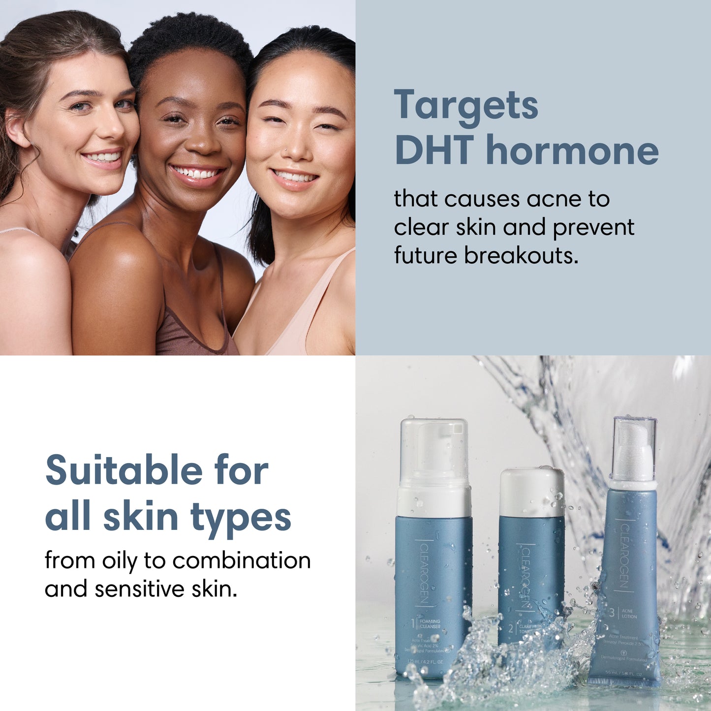 30-Day Sensitive Skin Acne Clearing 3 Step Treatment with Salicylic Acid