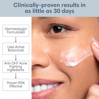 30 Day Benzoyl Peroxide Acne Lotion