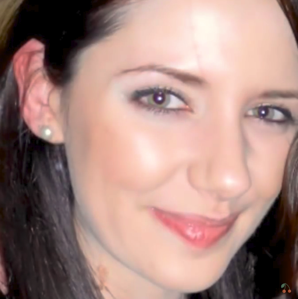 After using Clearogen