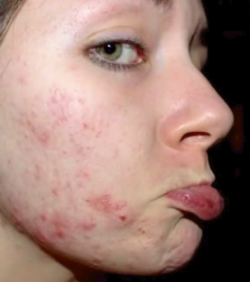 Before using Clearogen