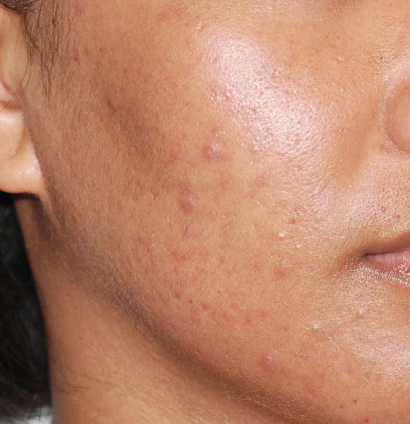 Before using Clearogen