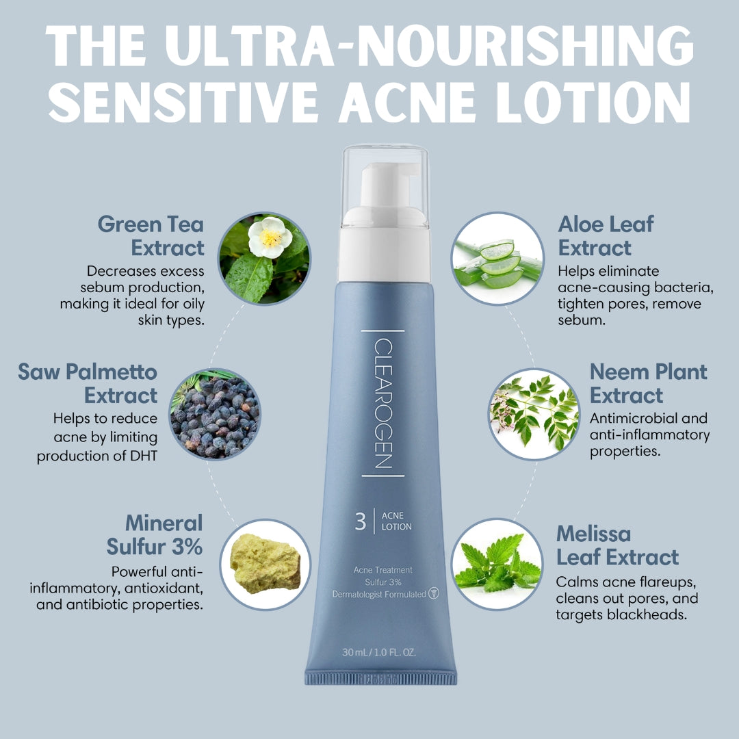 30 Day Acne Treatment Kit for Sensitive Skin